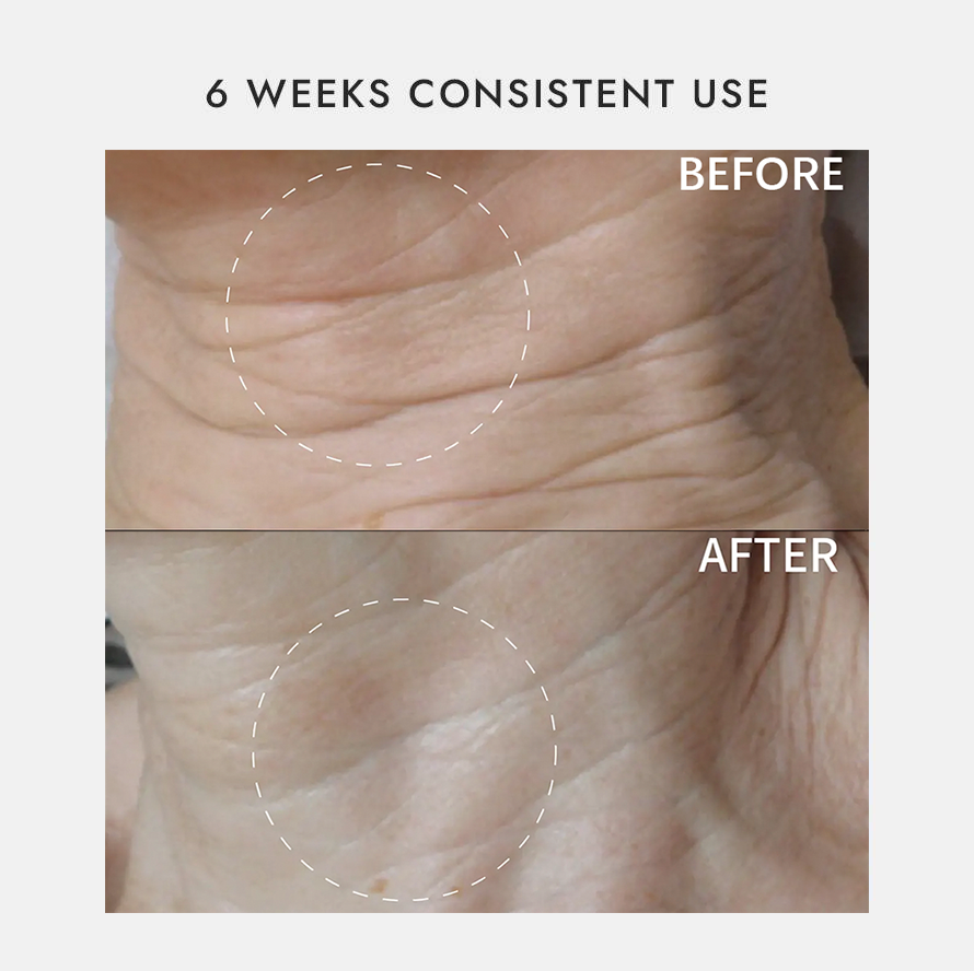 DēpLux Instant Facelift Device+Gel