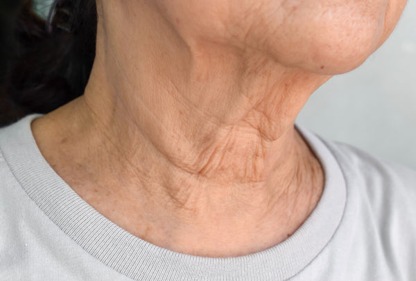 7 Anti-Aging Tips to Snap Back Sagging Neck Skin